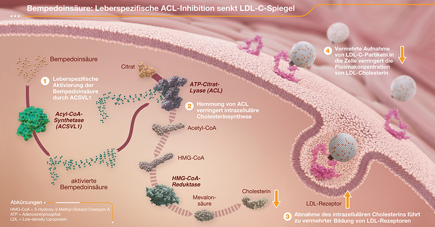 Die Hemmung der Adenosin-Triphosphat-Citrat-Lyase (ACL) in der Leber reduziert die Cholesterinbiosynthese und senkt die LDL-C-Spiegel.